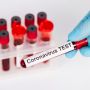 За тиждень від коронавірусу померли 24 людини в Хмельницькій області