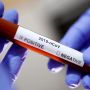 Менше 100 людей захворіли на коронавірус в Хмельницькій області