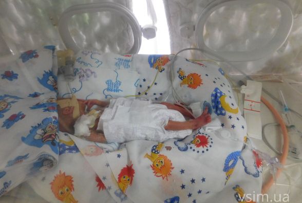 Її вага 530 грамів, а вона вже “борець”: у хмельницькому пологовому народилося недоношене немовля