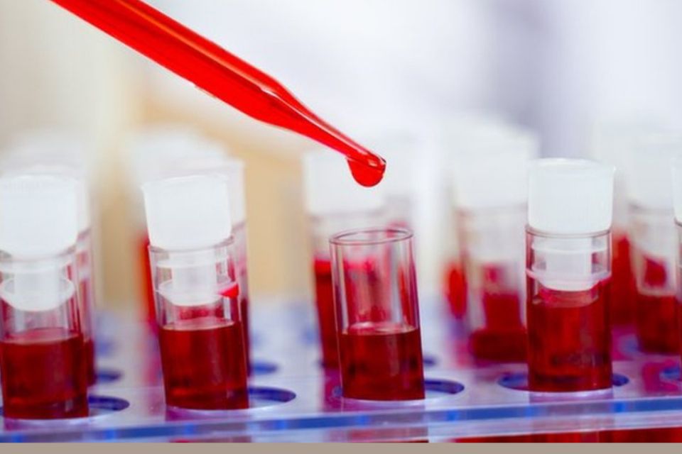 На Хмельниччині поширюється ВІЛ: медики закликають обстежитися