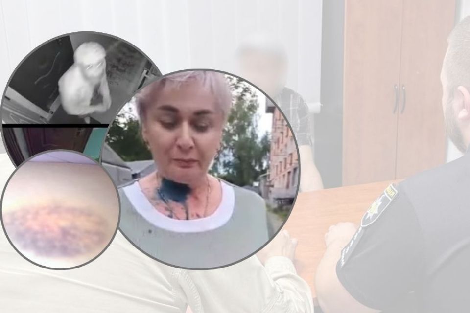 «Погрожував спалити разом із квартирою»: історія Оксани з Дунаєвець, яку переслідував колишній