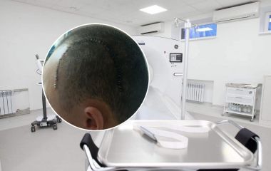 На Хмельниччині п'яна компанія проломила череп колишньому військовому: що відомо