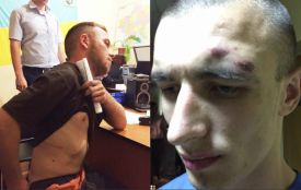 Адвокат надав фото побоїв Гуменюка і Бурлика