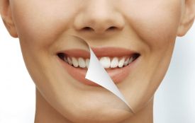 Ефективні методи відбілювання зубів: що пропонують стоматології Хмельницького