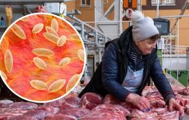 У Хмельницькому зареєстрували 2 хворих на бруцельоз. Які симптоми хвороби?