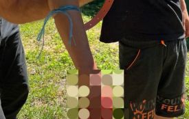На Хмельниччині в руках дитини вибухнув боєприпас: хлопчик втратив пальці