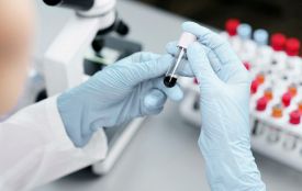 У хмельницькій стоматполіклініці відкрили пункт забору крові