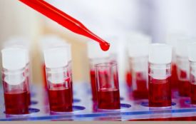 На Хмельниччині поширюється ВІЛ: медики закликають обстежитися