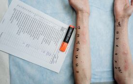 Коли імунна система дає збій: що робити з алергією? (новини компаній)