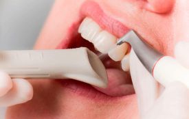 Профілактика зубного каменю: секрети здорової посмішки (новини компаній)