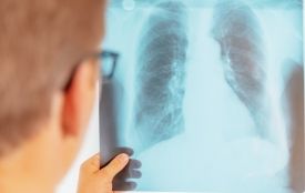 На Хмельниччині фіксують нові випадки туберкульозу серед підлітків