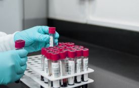 Сплеск гепатитів на Шепетівщині пов’язують із косметичними процедурами