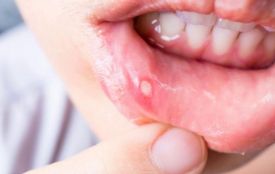Стоматит наприкінці зими: чому виразки в роті загострюються перед весною? (новини компаній)