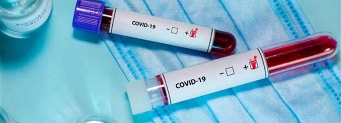 COVID на Хмельниччині: за добу підтвердили 4 нові випадки, ще 1 людина одужала