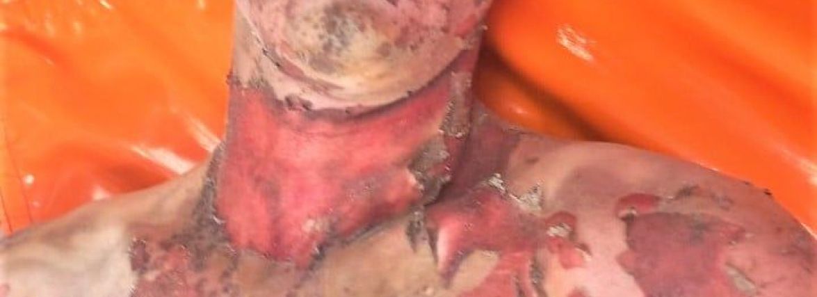 Біля залізниці знайшли чоловіка з опіками. Поліція просить допомогти встановити особу