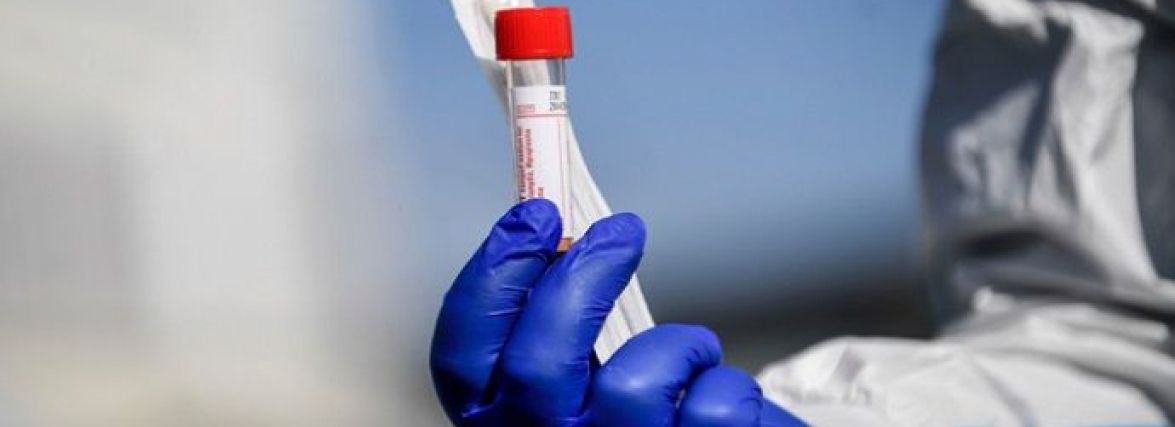 За вихідні на Хмельниччині +62 хворих на Covid: скільки у лікарнях