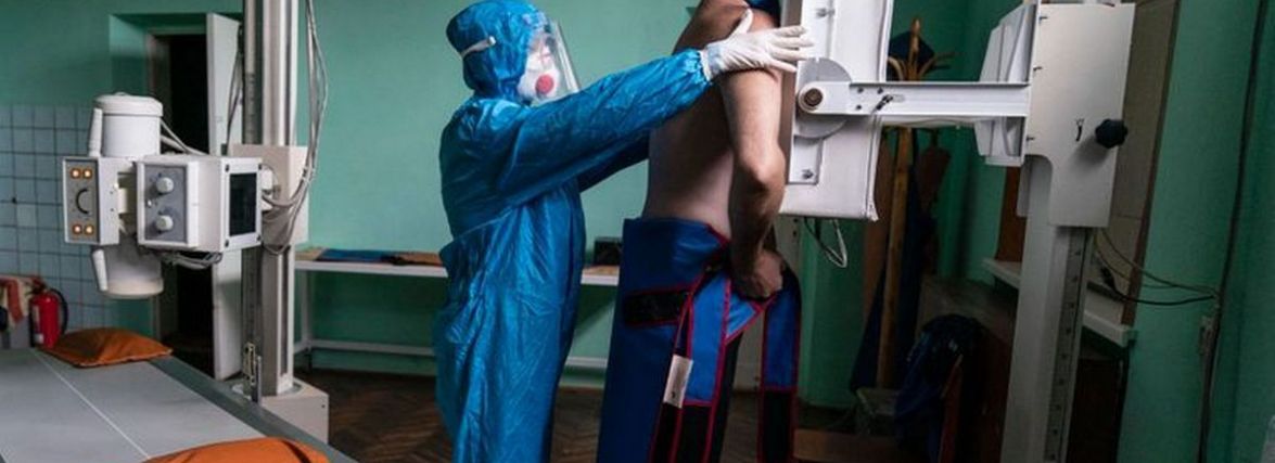 На Хмельниччині +1294 хворих на COVID. Зареєстрували 12 смертей
