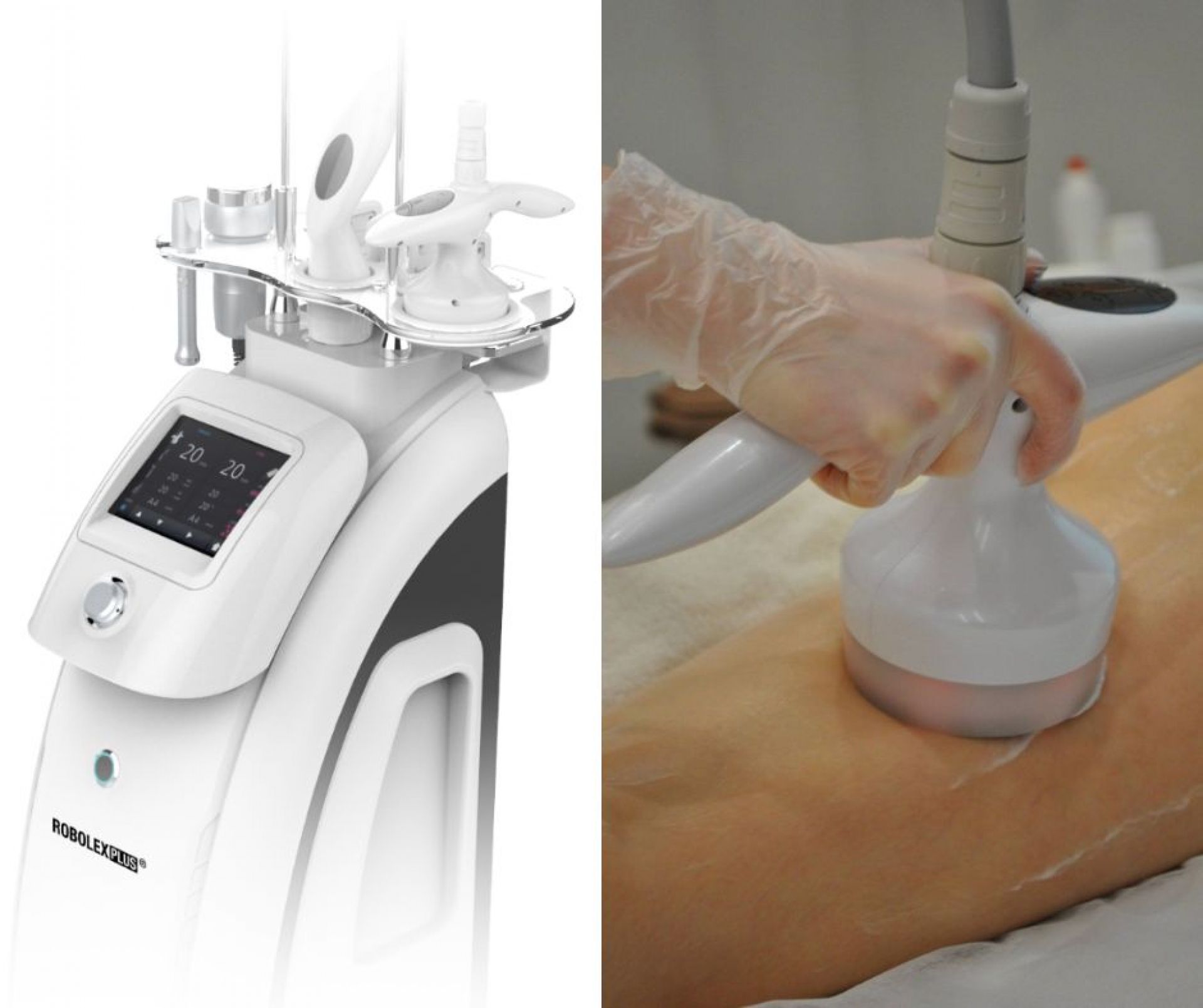 Апарат нового покоління для моделювання тіла і обличчя Robolex Plus